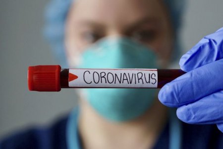Dünyada koronavirusdan ölənlərin sayı 600 mini ötüb