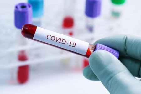 Gürcüstanda koronavirusa yoluxanların sayı 497 nəfərə çatıb