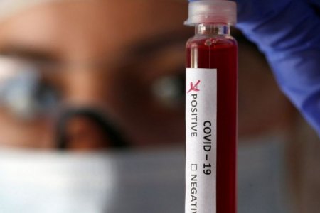 Azərbaycanda koronavirus aşkarlanmış 33 məhkum karantinə yerləşdirilib