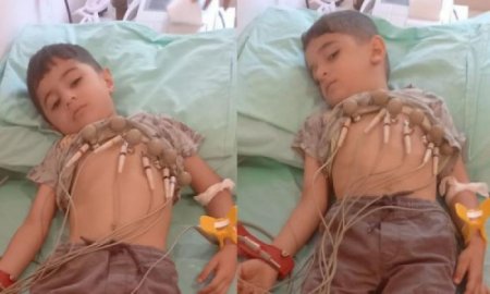 Əkiz qardaşların yardıma ehtiyacı var - VİDEO - FOTO